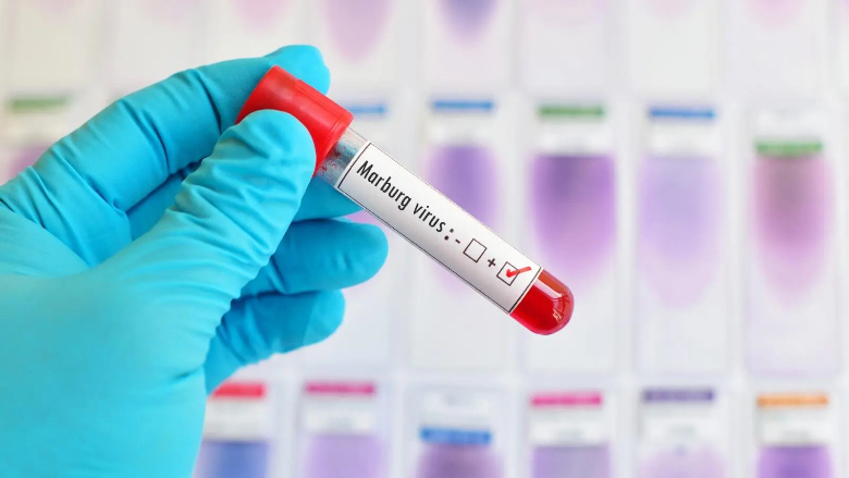 علاج فيروس ماربورغ