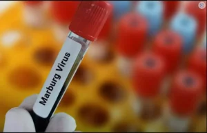 فيروس ماربورغ، حقيقة المرض، خطورته وطرق انتشاره