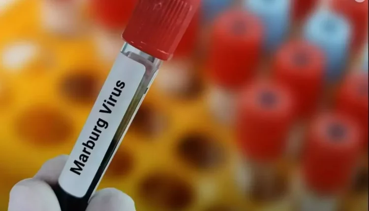انتشار فيروس ماربورغ